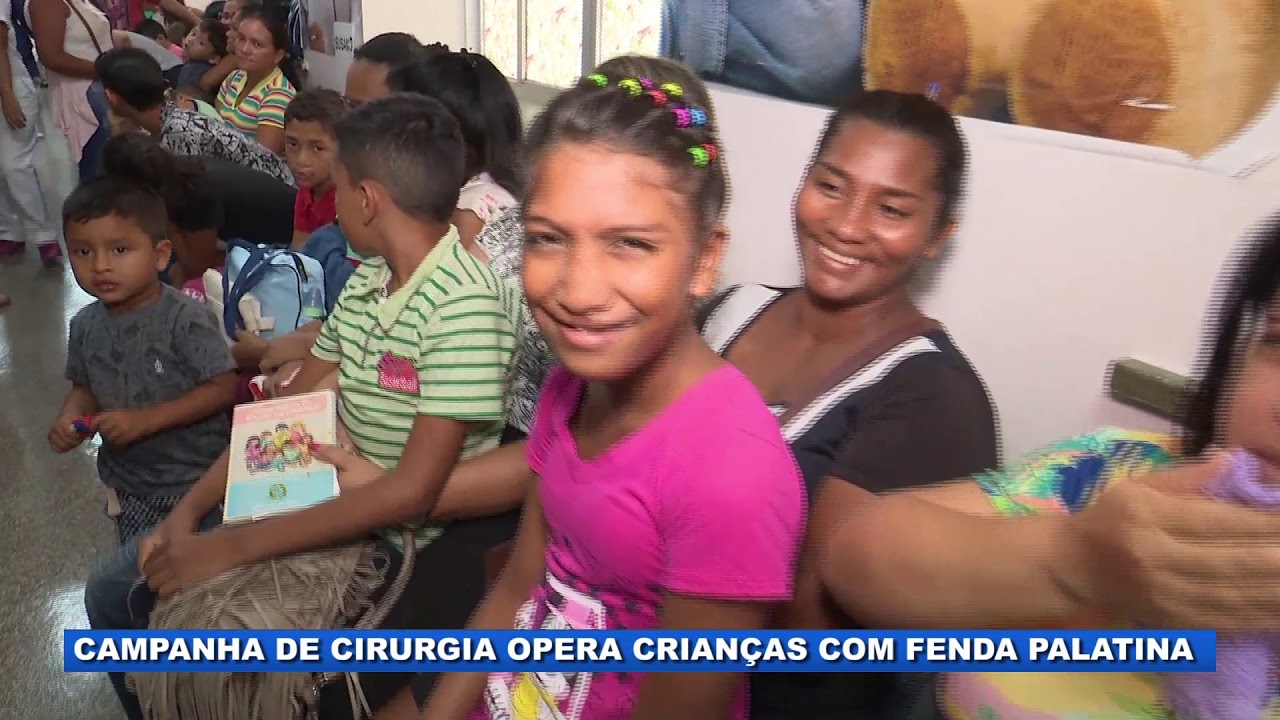 Campanha de cirurgia opera crianças com fenda palatina