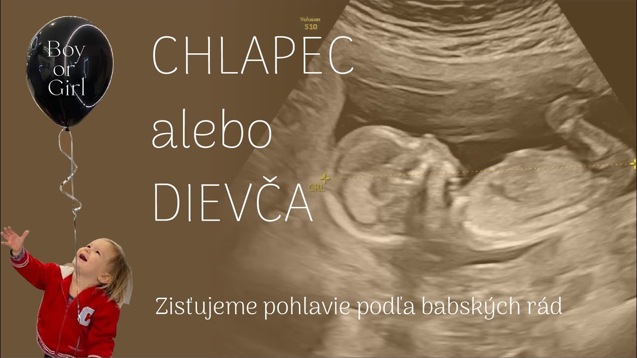CHLAPEC alebo DIEVČA? Zisťujeme pohlavie podľa 