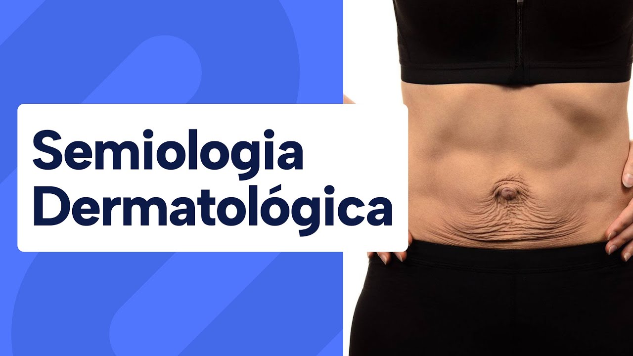 Semiologia Dermatológica - Exame de Pele #semiologia #medicina #dermatologia