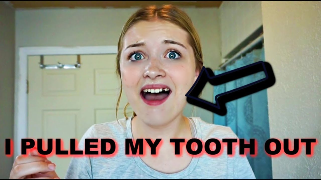 I PULLED MY FRONT TOOTH OUT