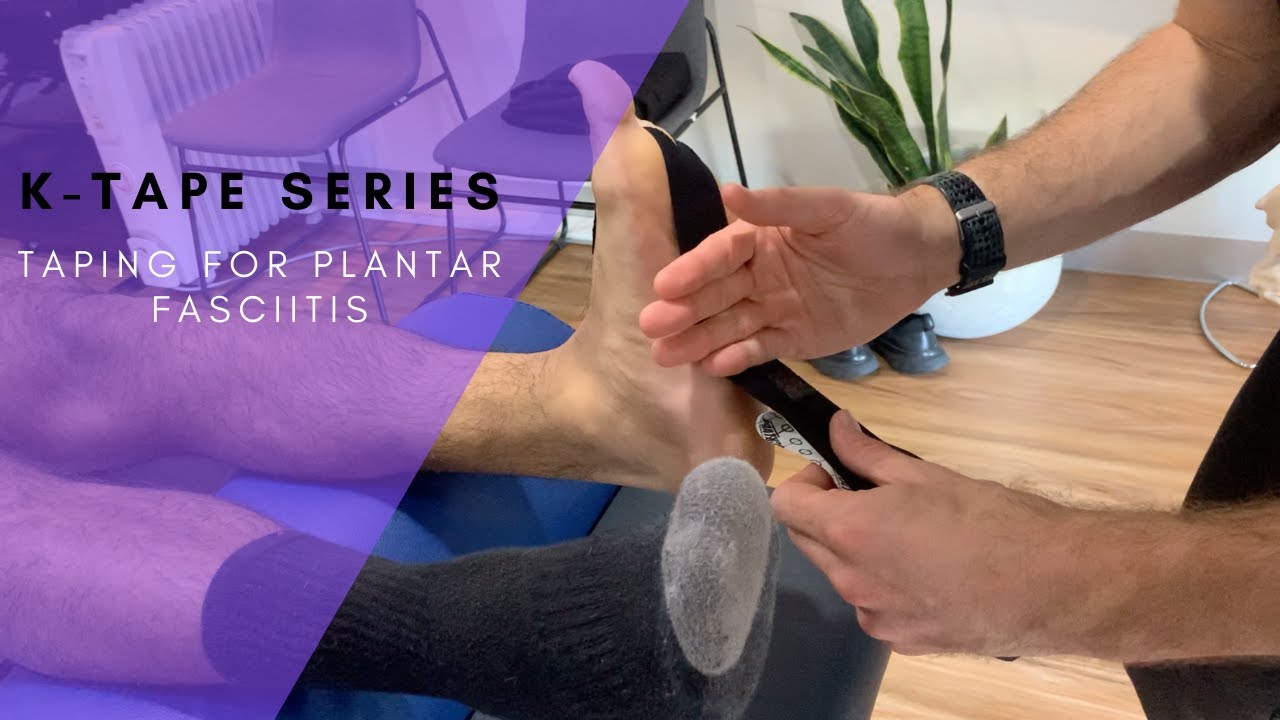 K-taping for Plantar Fasciitis