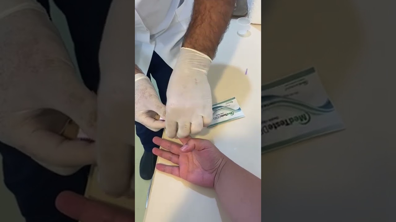 Coleta NS1 de Dengue