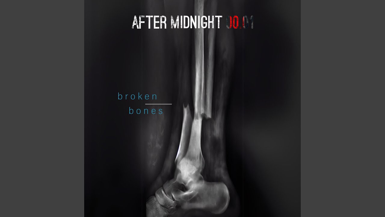 Broken Bones