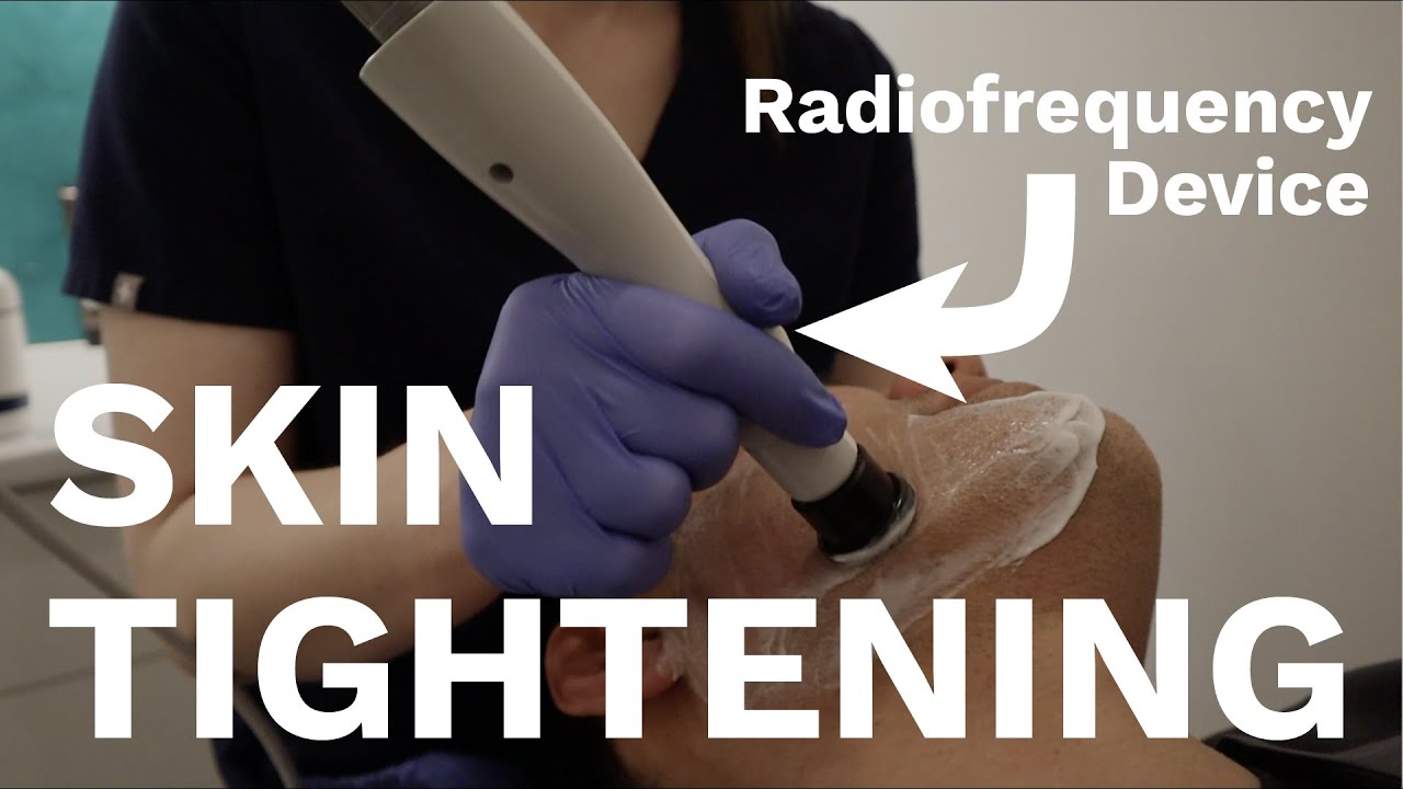 The BEST devices for Skin Tightening | Dr Davin Lim