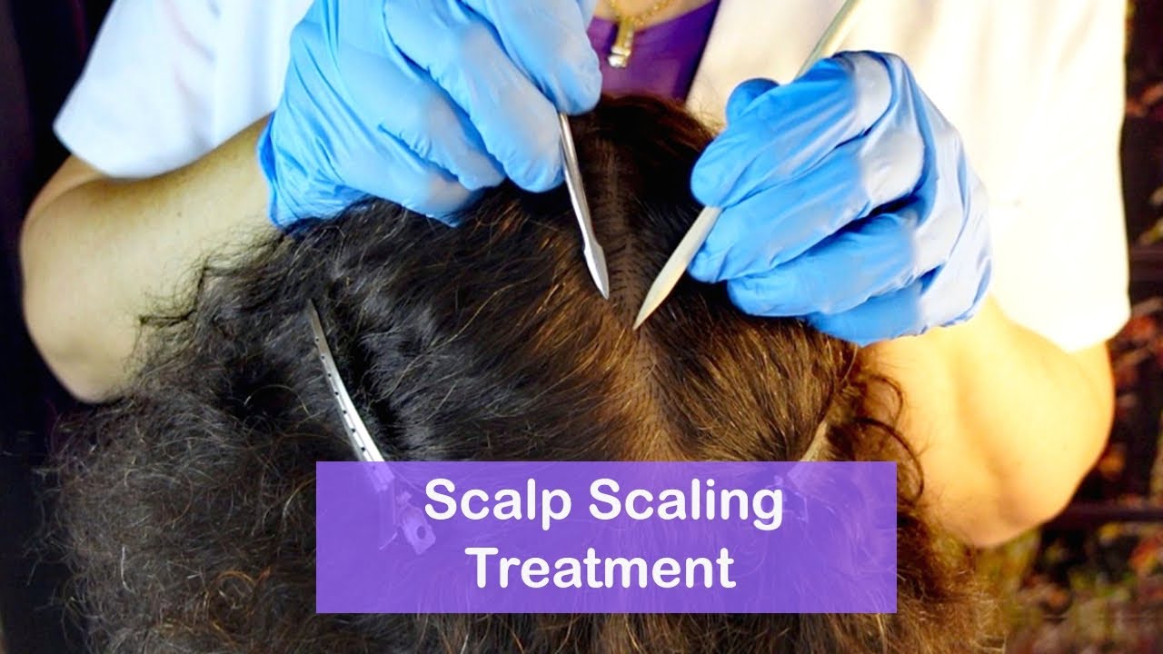 ASMR Dandruff Removal & Scalp Check with Bad Results (Whispered)