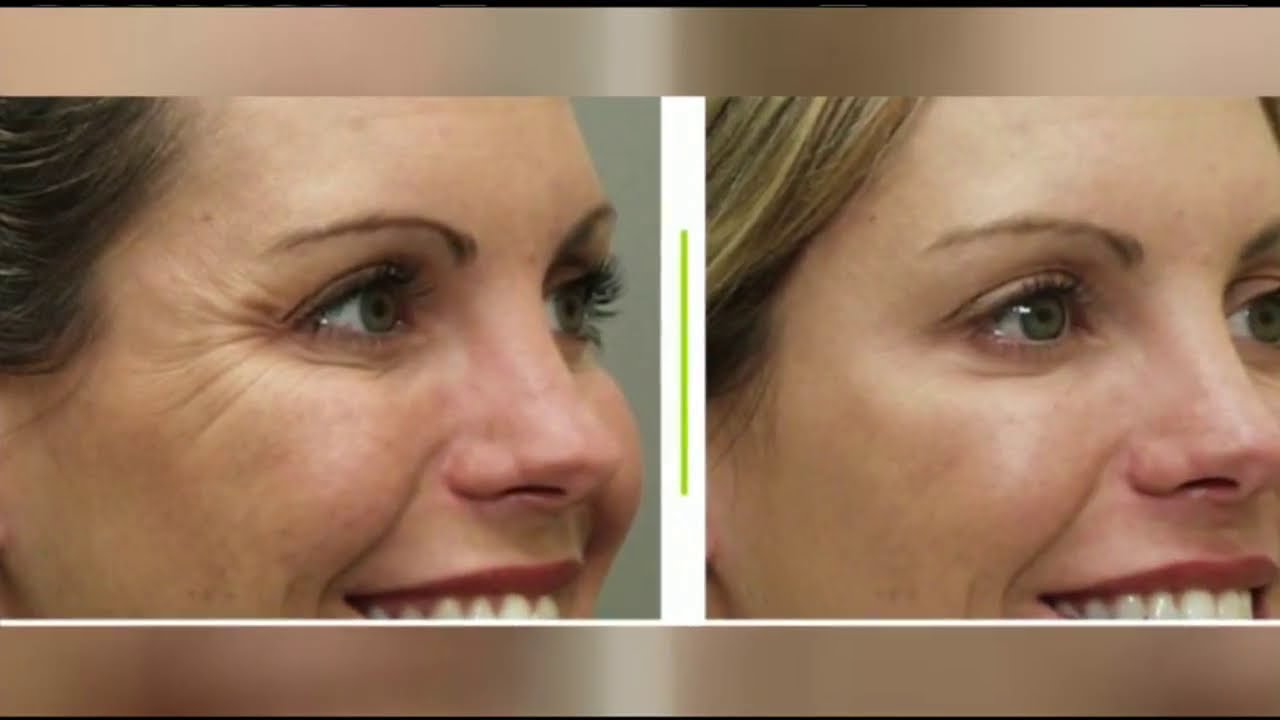 Mass Appeal Defy aging with Bella MedSpa And Medical Aesthetic Procedures