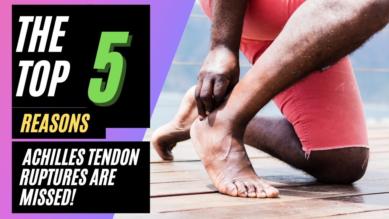 The TOP 5 REASONS Why Achilles Tendon Ruptures Can Be Missed!