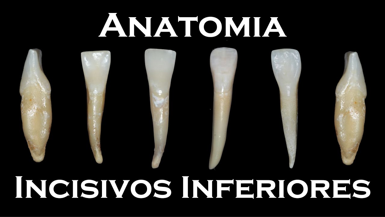 Anatomia dos Incisivos Inferiores: Central e Lateral