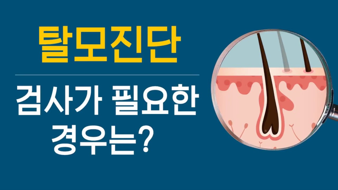 탈모진단시 검사가 필요한 경우 (제61강)