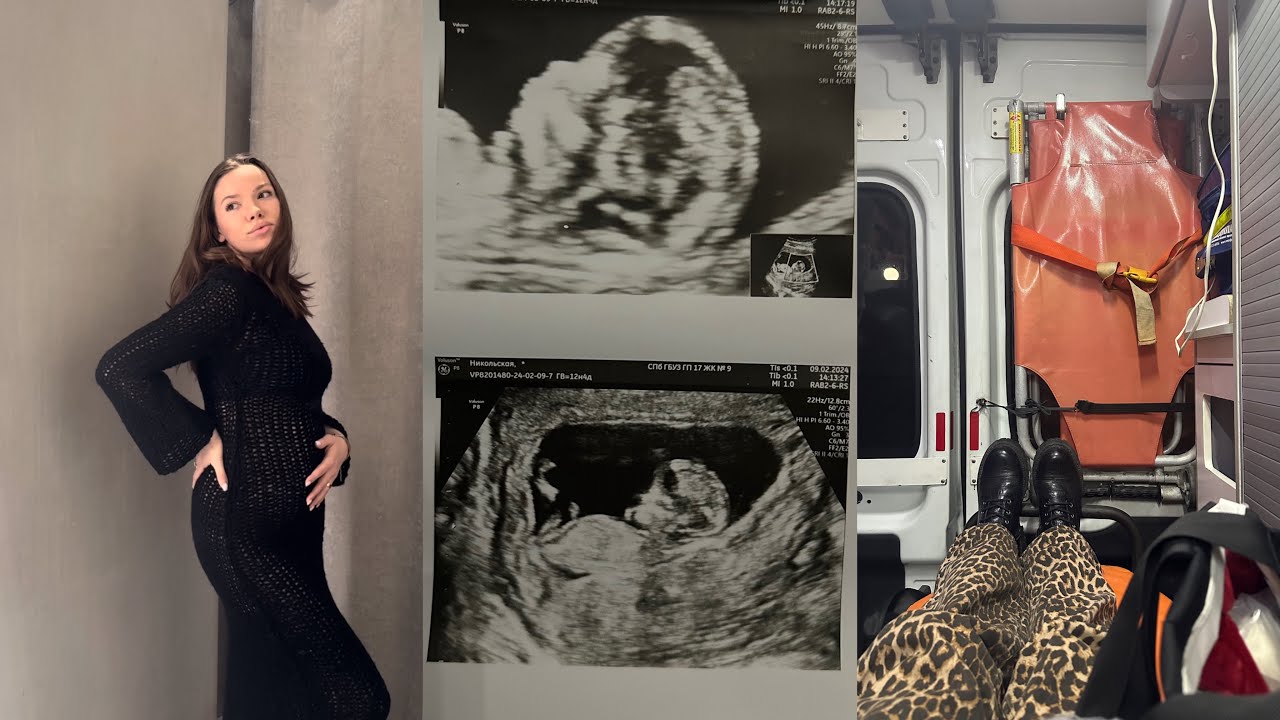 Я БЕРЕМЕННА/ 1 триместр🤰🏻