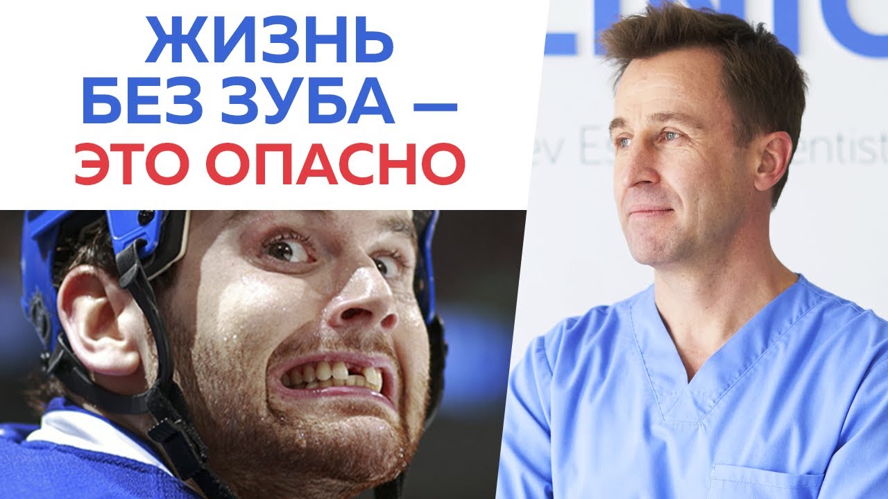 Чем опасно отсутствие зуба? / Почему важно вернуть утраченный зуб как можно скорее?