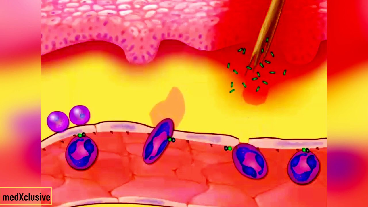Inflammatory Response [Introduction]