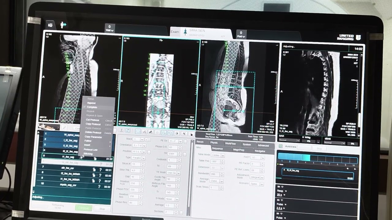 MRI LS SPINE planning in UMR 580 UNITED IMAGING 1.5T
