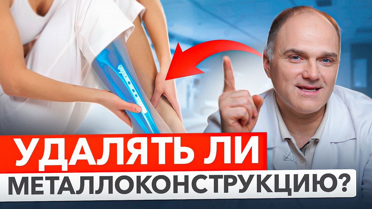 Что будет если не удалять ПЛАСТИНЫ, ВИНТЫ после срощения перелома перелома?