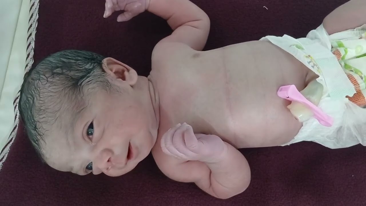 Hello Mom ,Hello Family ,Iam Came Cameat Your Home From Mom Abdomen World 