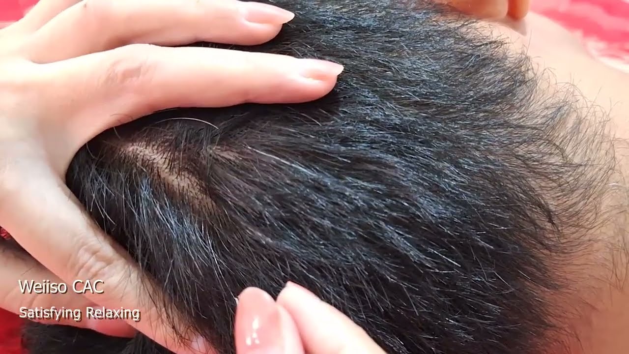 Satisfying Relaxing Cabut Uban #12