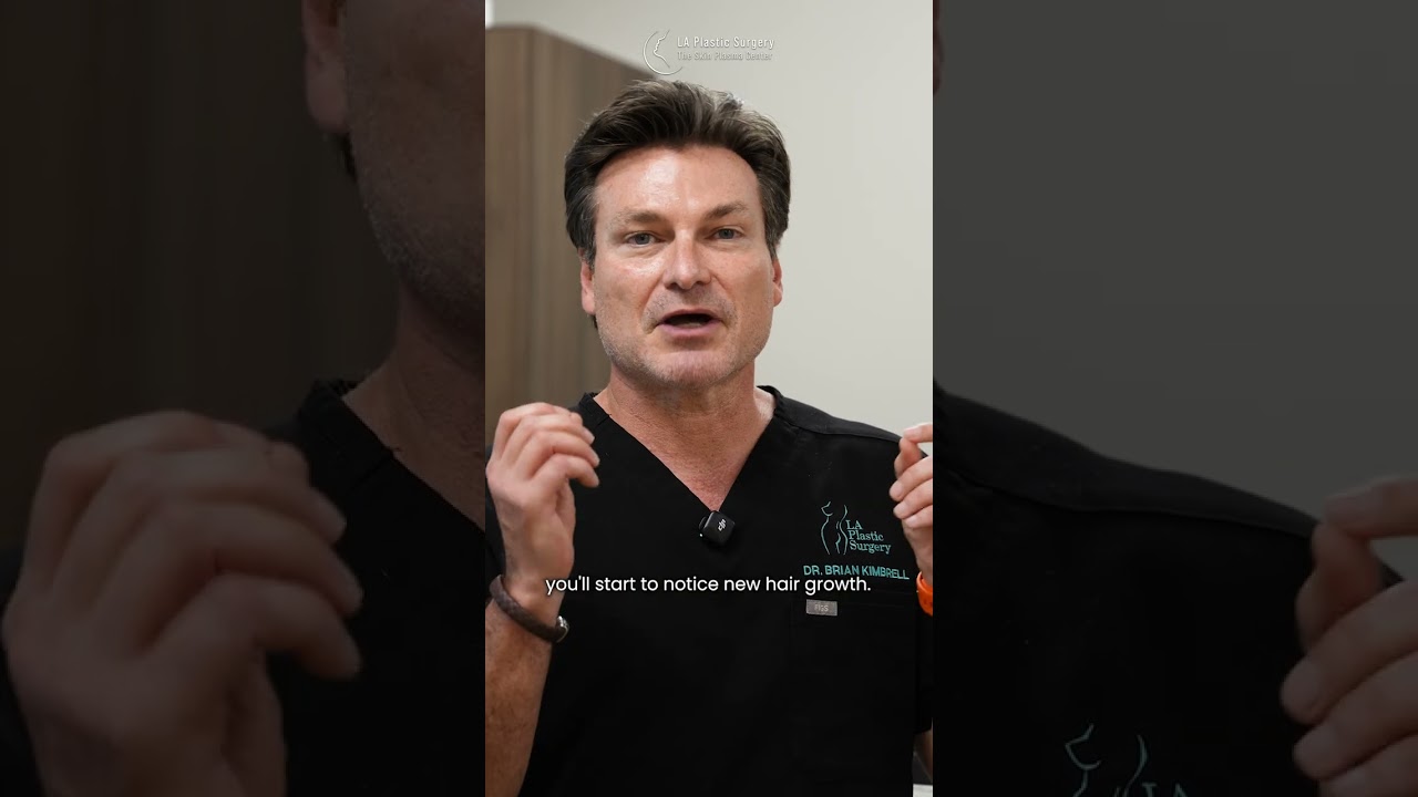 What To Expect After PRP and Exosomes for Hair Loss
