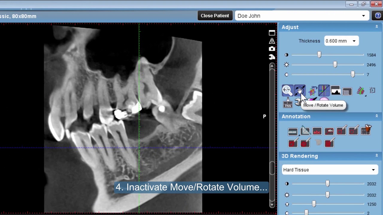 Five Ways To Manipulate A 3D Volume