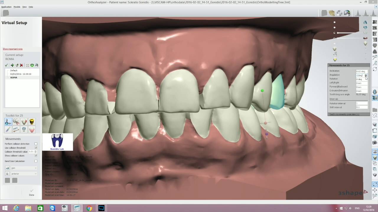 Orthoanalyzer complete orthodontic digital set up using variοus tools