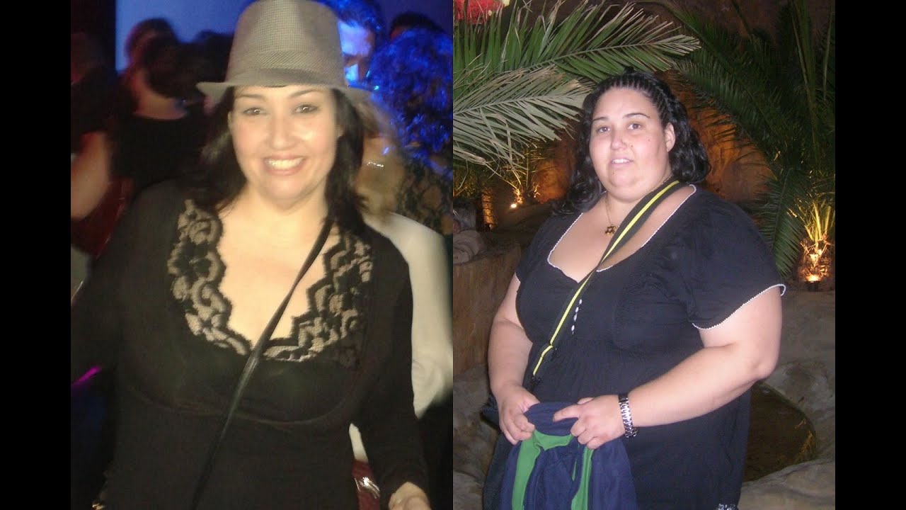 He Perdido 78 Kg .La Nueva Vida de Guadalupe después del Bypass Gástrico