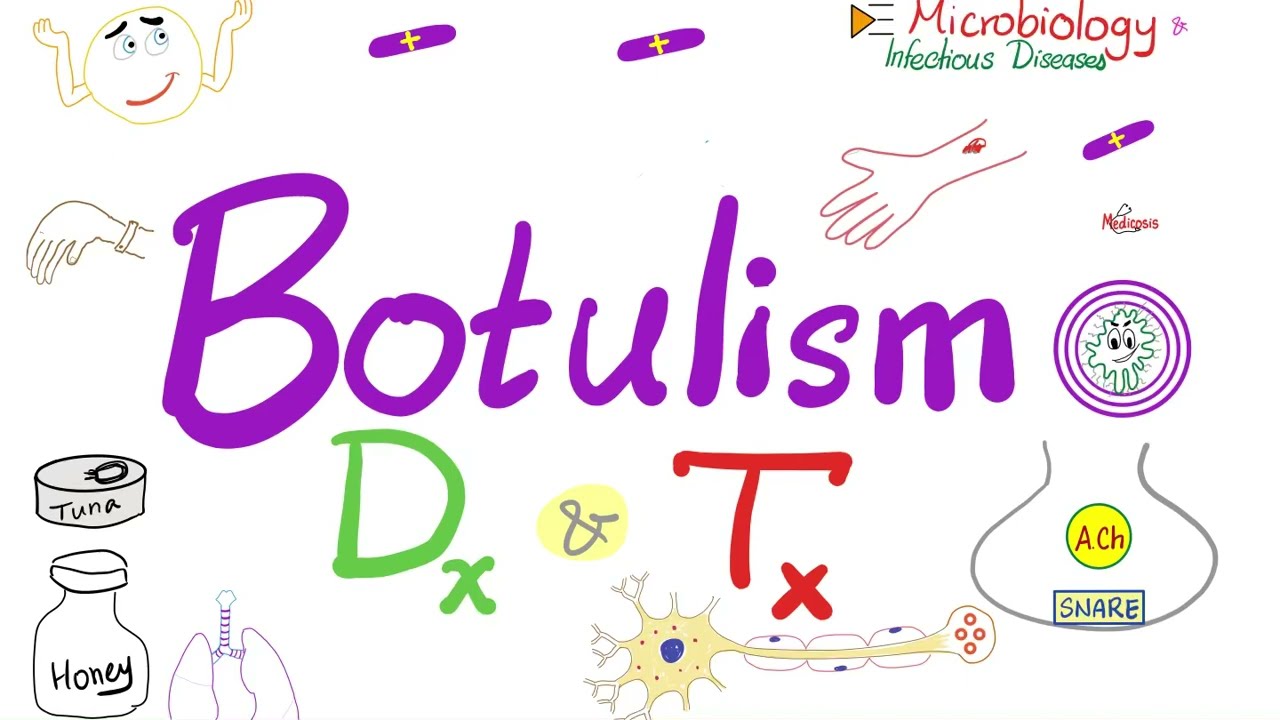 Clostridium botulinum (Botulism) | Diagnosis & Treatment