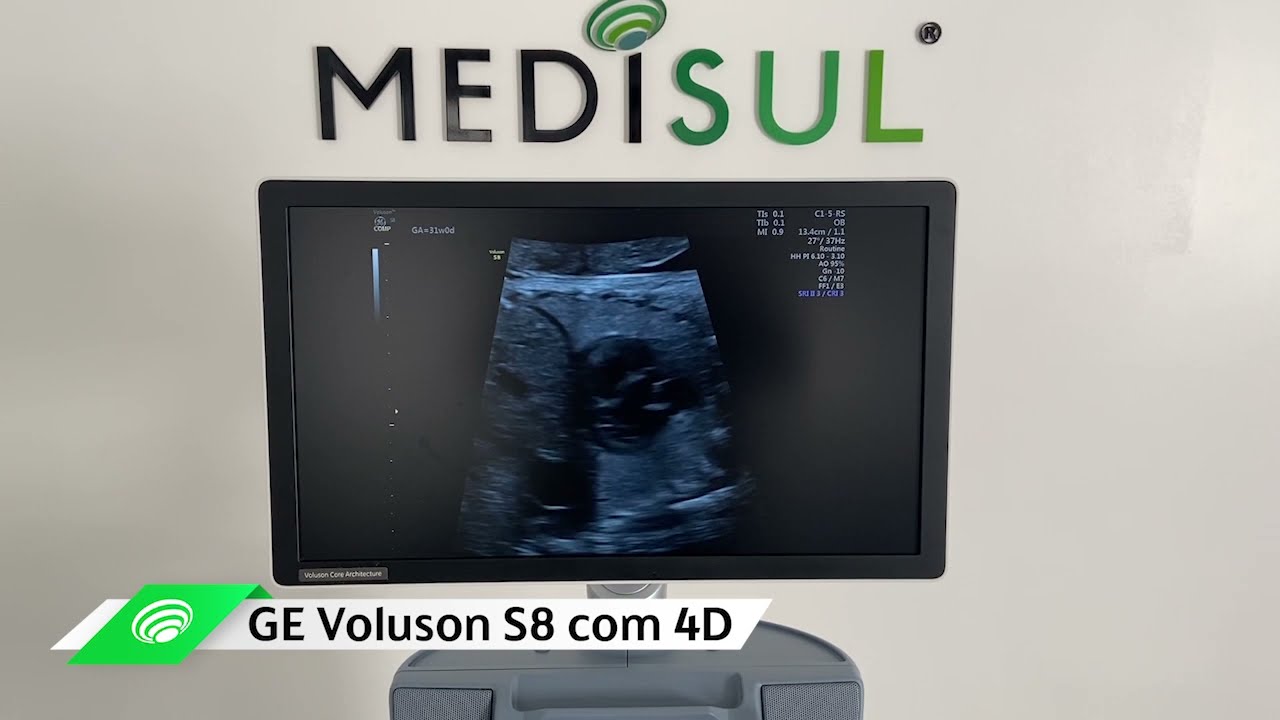 Medisul - GE Voluson S8 com 4D