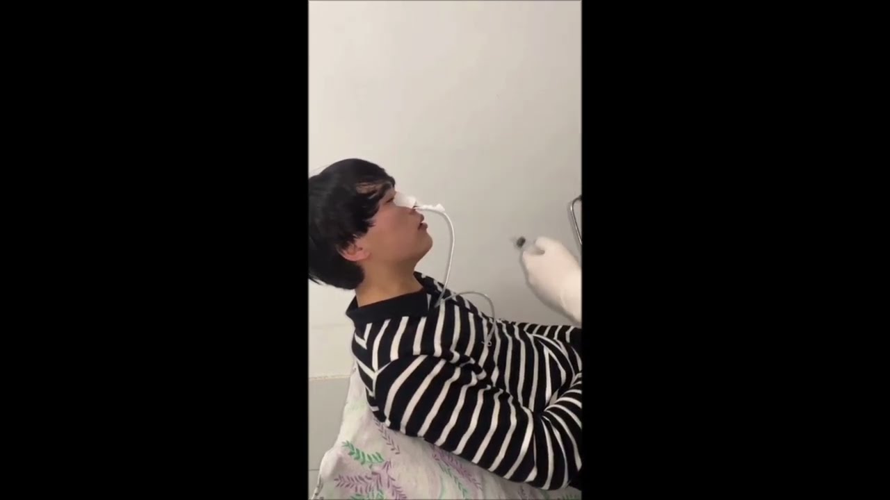 Oshqozonga zond qo'yish.Nasogastric (NG) Tube Insertion.Введение назогастрального зонда в желудок