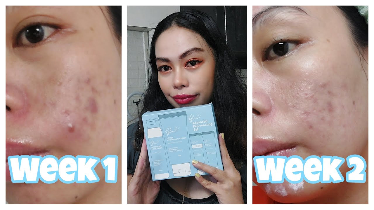 I Tried The Hello Glow Advanced Rejuvenating Set for 3 Weeks: Here’s What Happened!