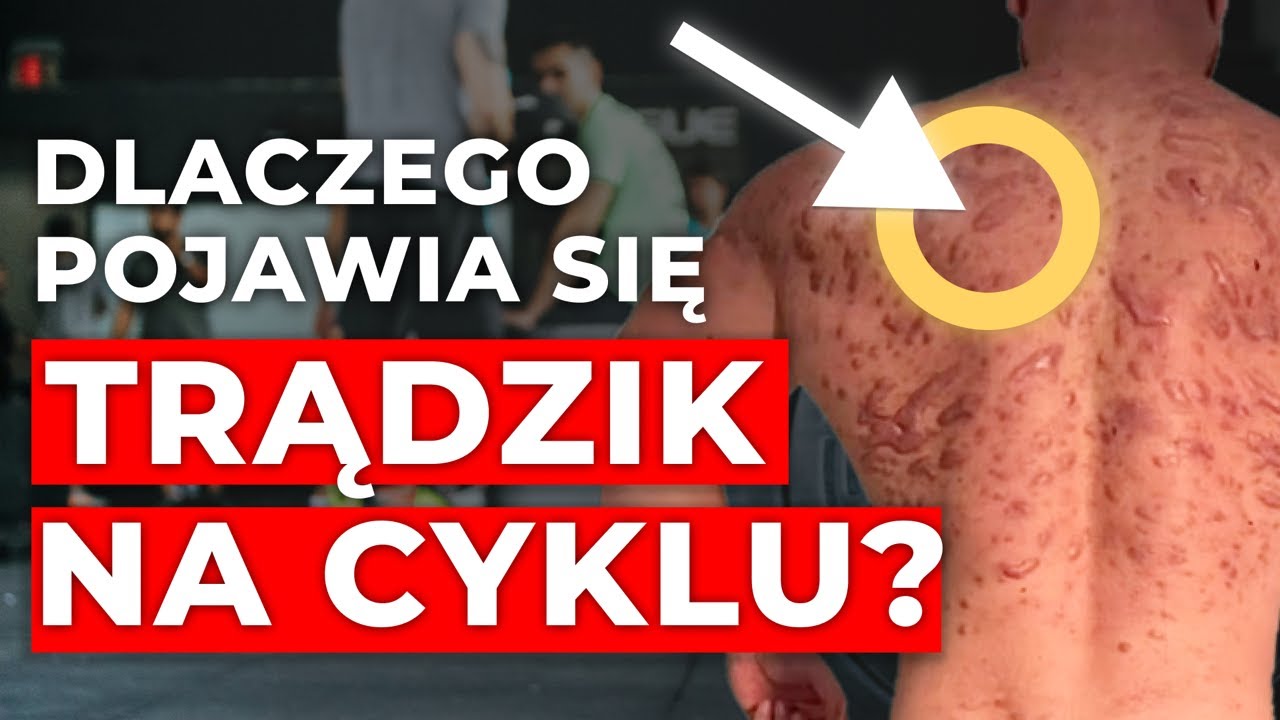 CO ZROBIĆ Z TRADZIKIEM?