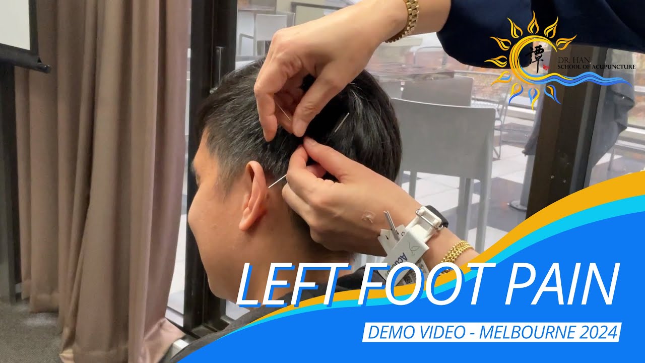 Foot Pain #逛街逛到腳痛 #正宗譚針 #譚針 #韓玉齡 #DrTanBalanceMethodAcupuncture #footPainAcupuncture #eileenhan