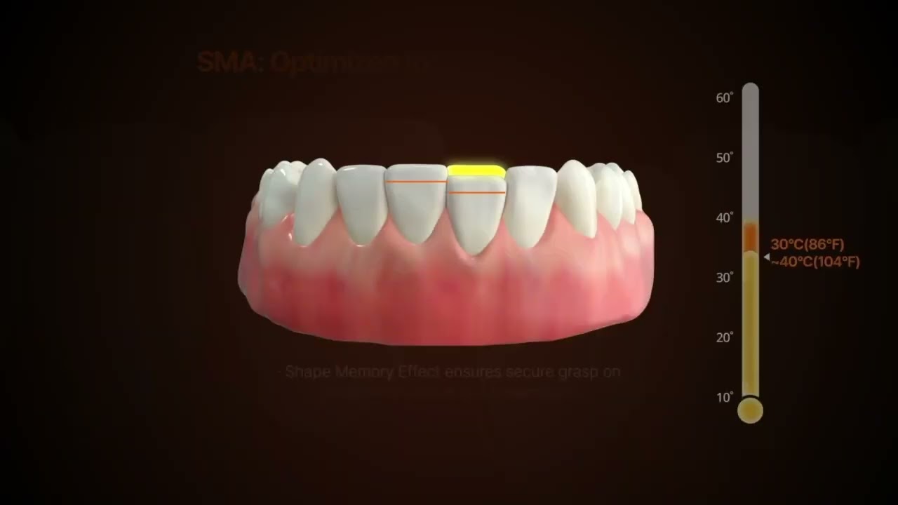 NEW Essence of Shape Memory Aligner 250321