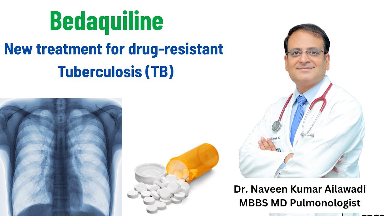 Bedaquiline New treatment for drug-resistant Tuberculosis (TB)  |  Dr. Naveen Ailawadi 8586805004