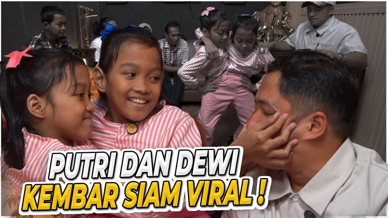 PUTRI DAN DEWI KEMBAR SIAM VIRAL!!