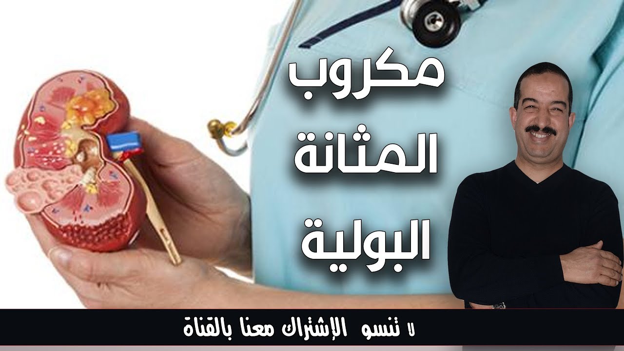 خطوات لعلاج التهاب المثانة من دون اللجوء إلى دواء