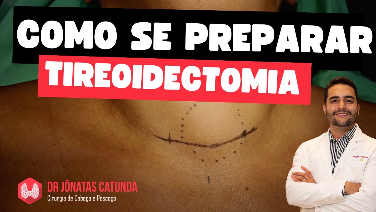 Tireoidectomia - como se preparar para a cirurgia e ter uma boa recupera&ccedil;&atilde;o sem complica&ccedil;&otilde;es