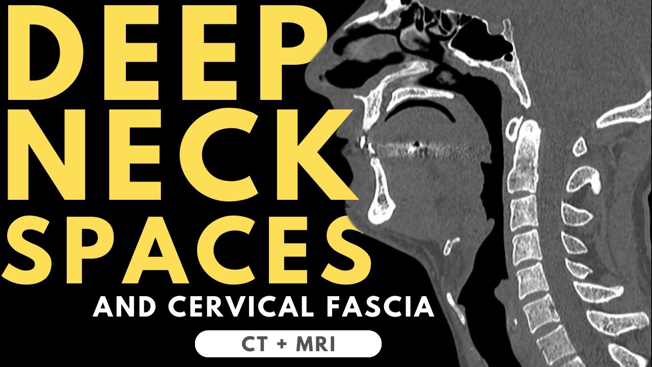 Deep neck spaces and deep cervical fascia anatomy | Radiology anatomy part 1 prep | CT and MRI