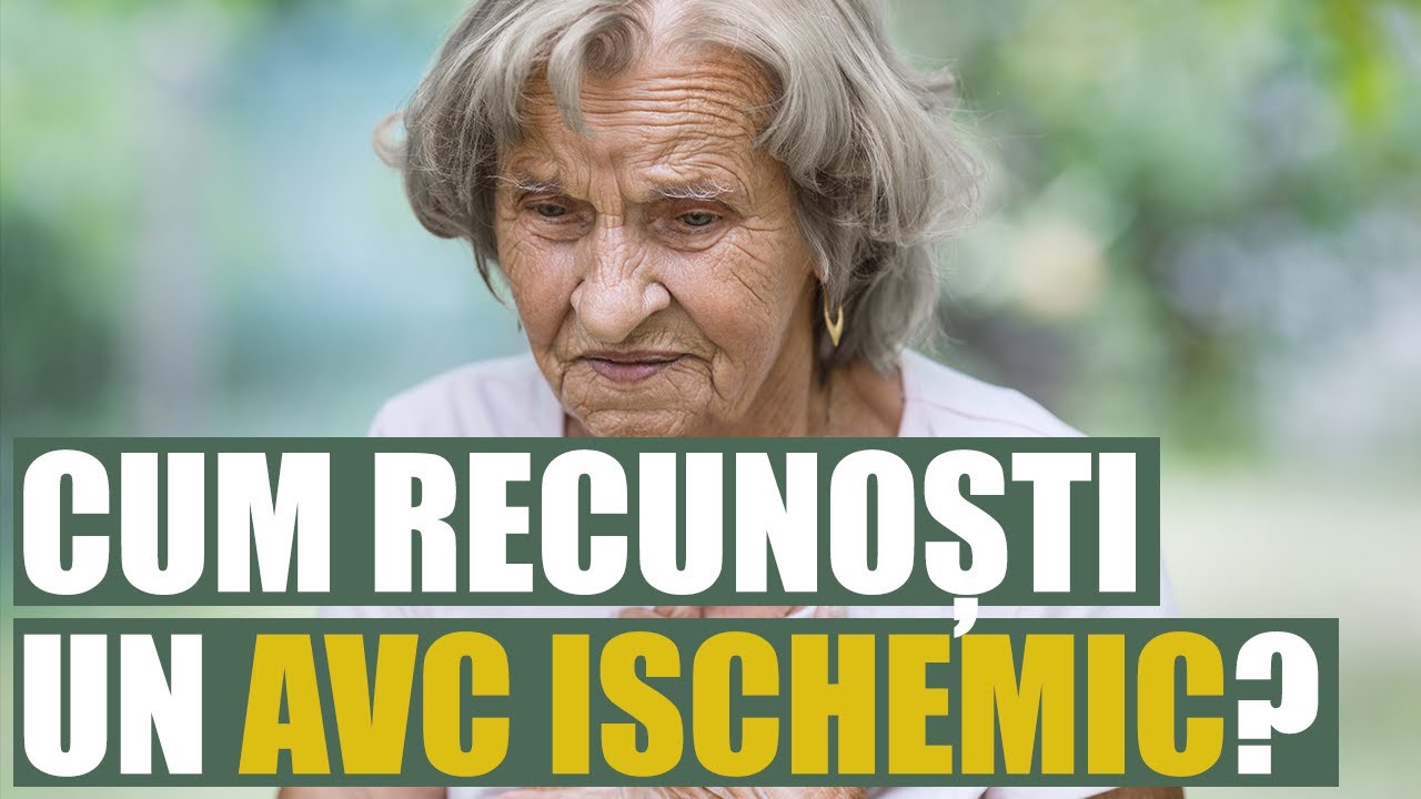 Cum recunoaștem un accident vascular cerebral ischemic și ce avem de făcut?