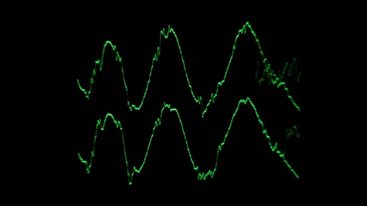 chess type beat (slowed) [no reverb]