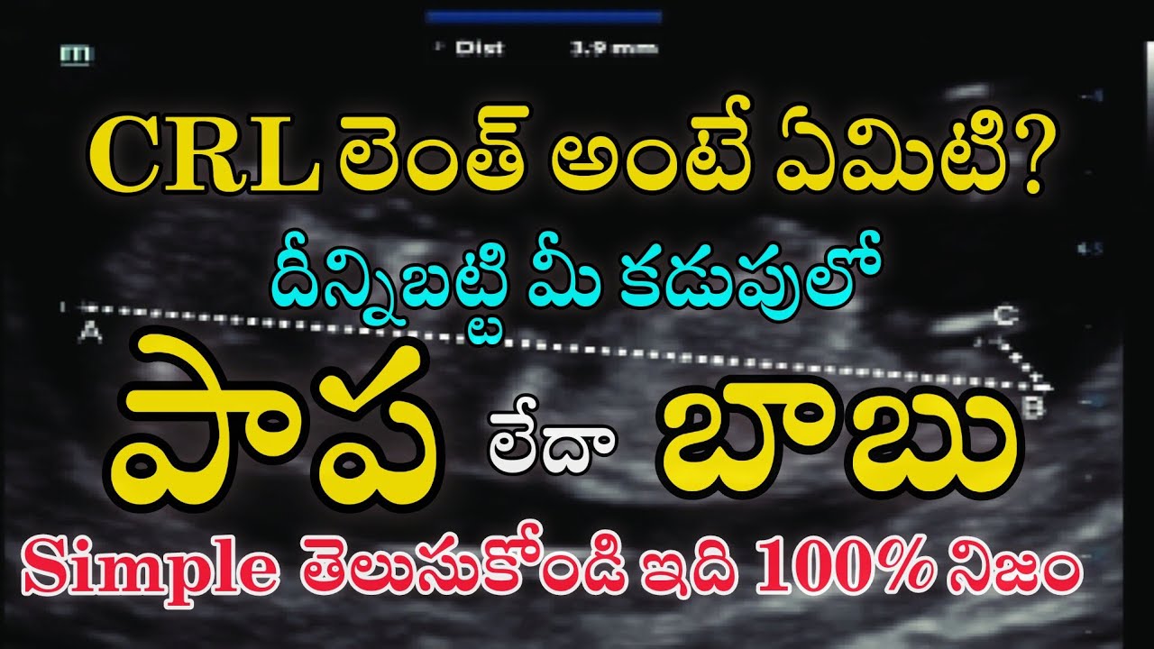 CRL Length ద్వారా మీ కడుపులో ఉంది ఎవరో ఈజీగా తెలుసుకోండి...||CRL Gender Prediction During pregnancy