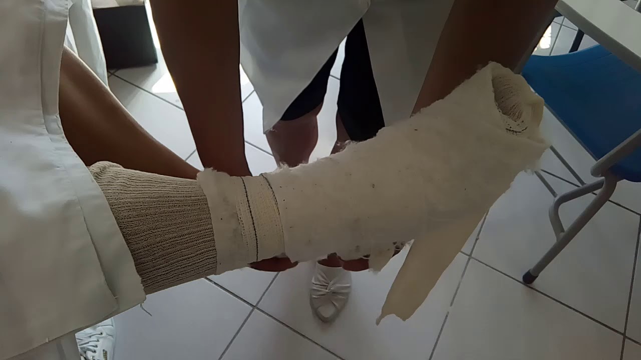 Enfaixamento compressivo (ou Jones p/tornozelo)