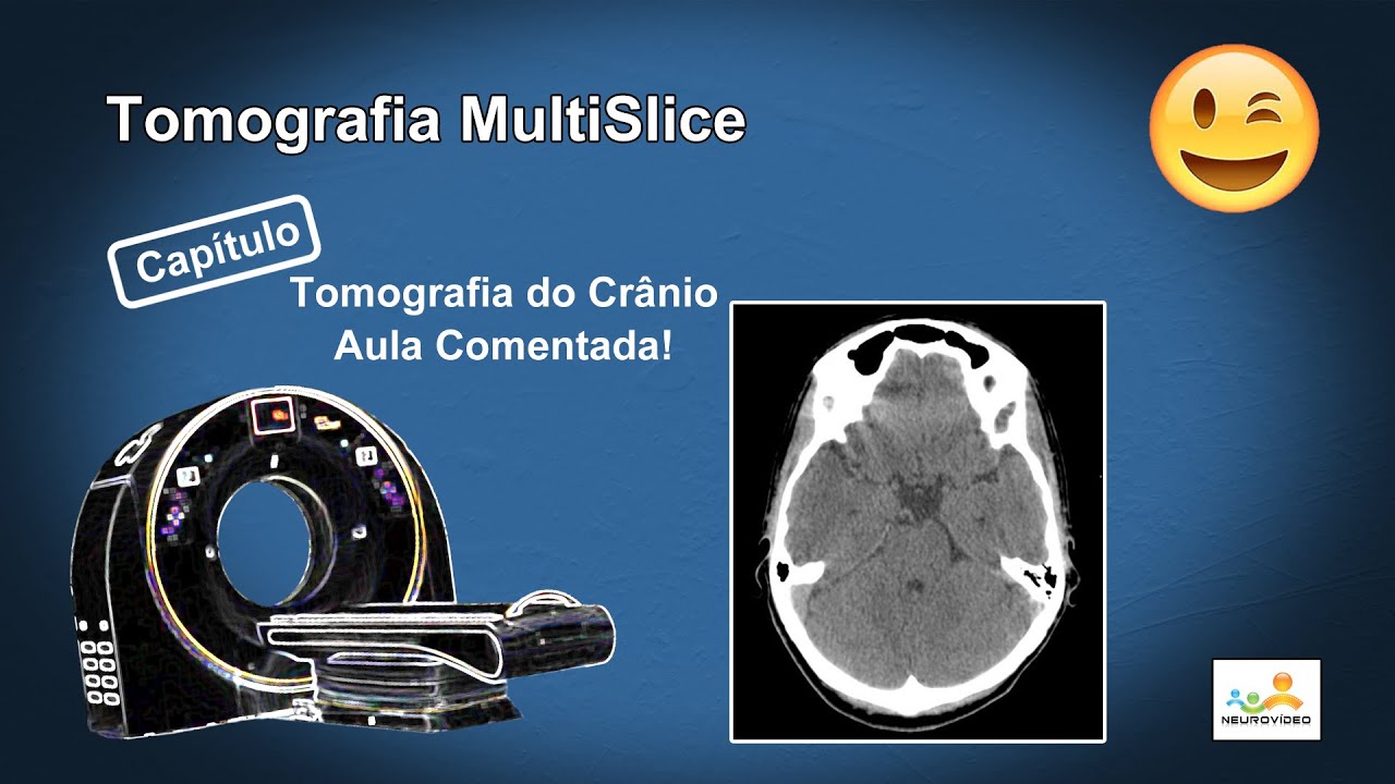 Tomografia do Computadorizada Crânio (Dicas e Truques)