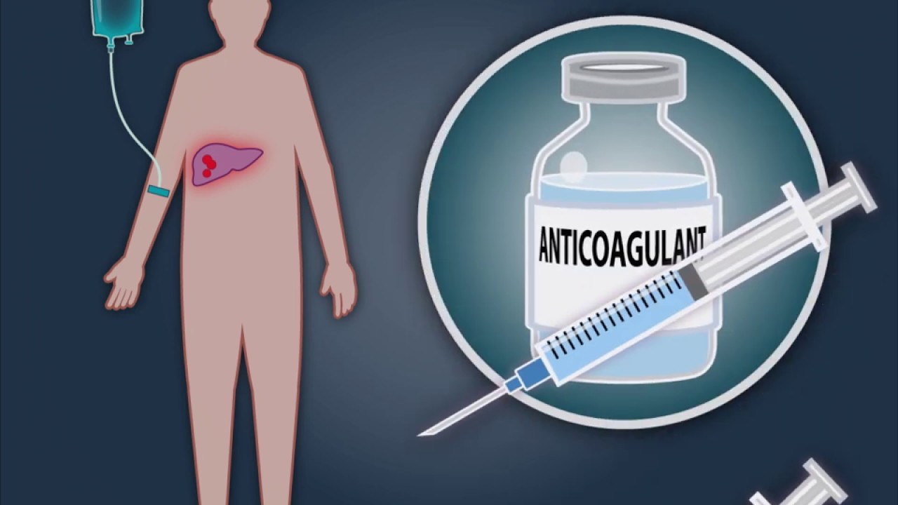 Reducing the Risk of Thromboembolism in Cancer