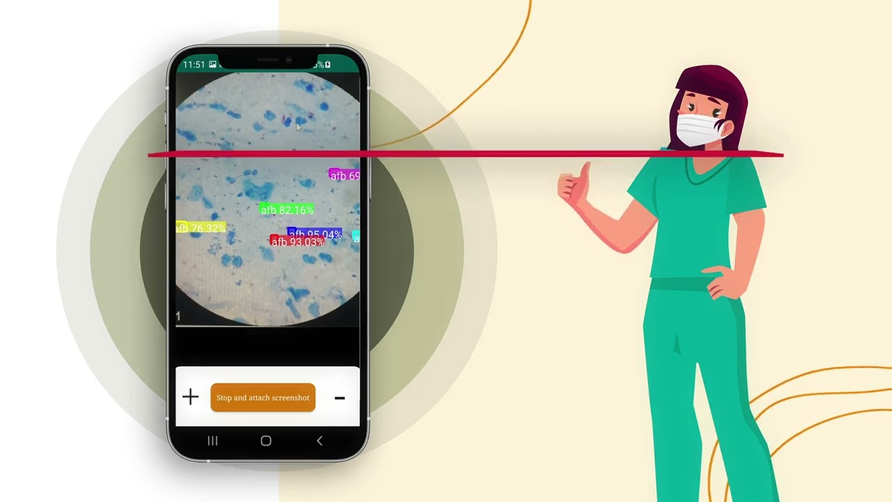 Sevamob demo: New case  identification + treatment compliance + nutrition support for Tuberculosis