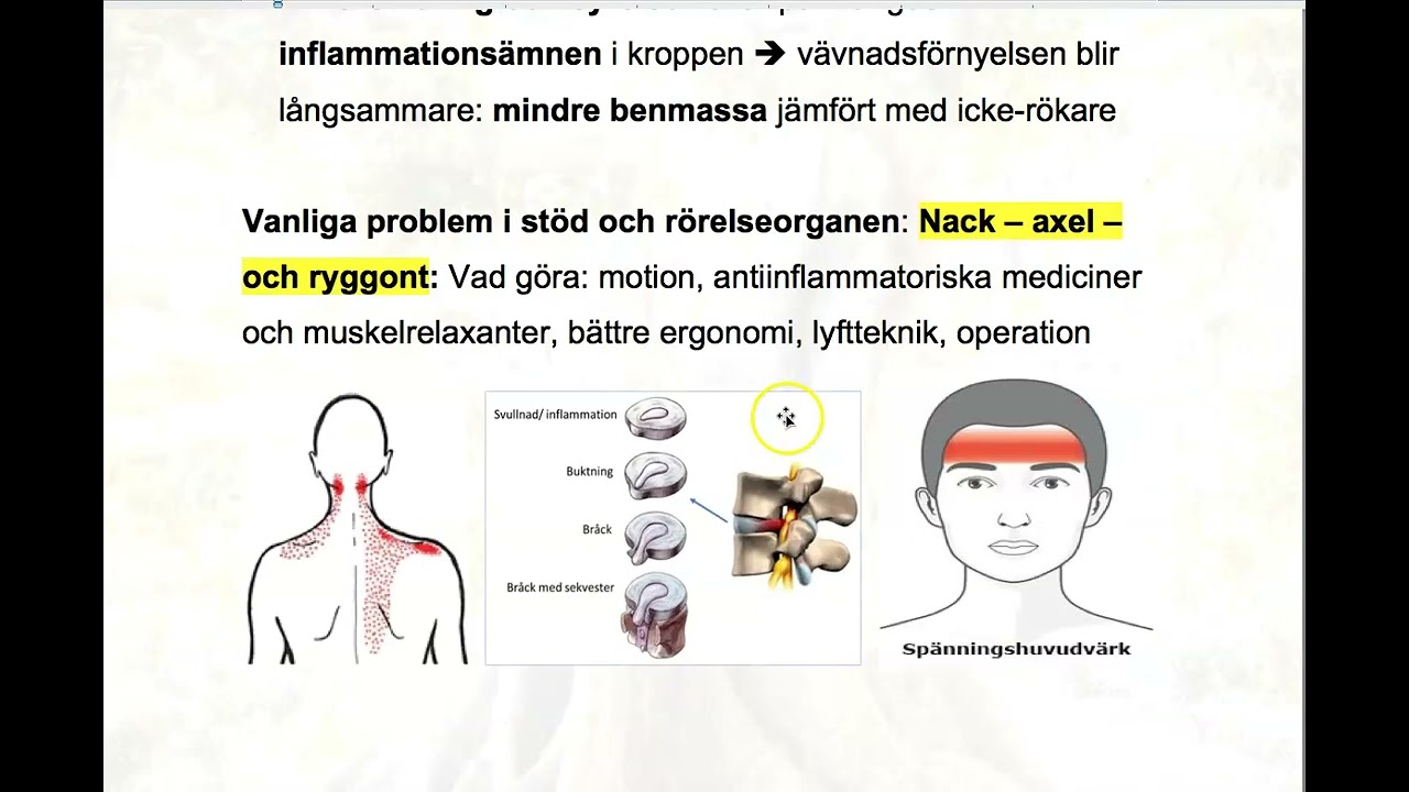 Lektion 11 Sjukdomar i st&ouml;d och r&ouml;relseorganen