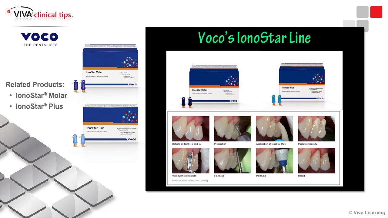 Dr. Geissberger on IonoStar Plus and IonoStar Molar