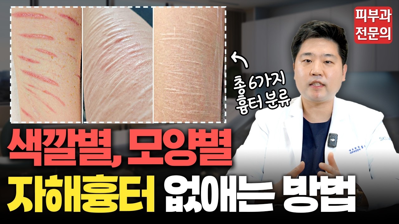 모두가 포기했던 2,500명의 자해흉터, 난치성 자해흉터를 치료하며 알게된 올바른 치료방법ㅣ6가지 자해흉터 치료방법 대공개!