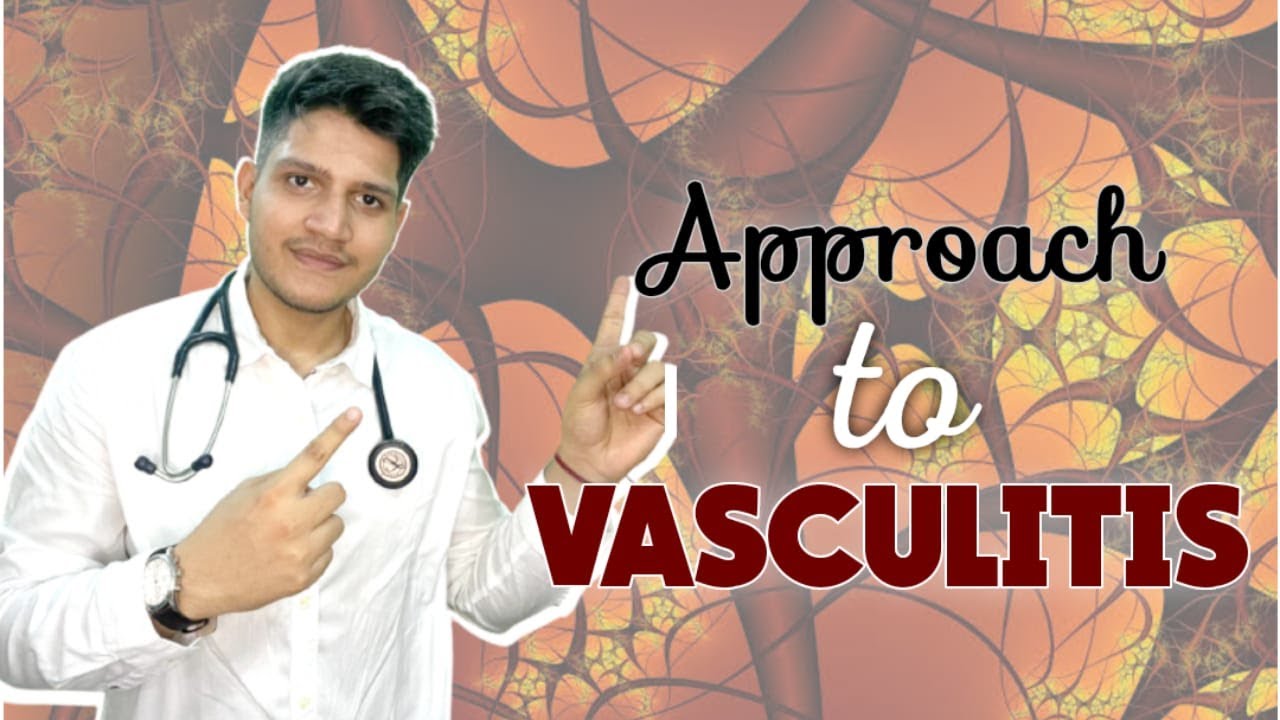 VASCULITIS | Classification | Approach | Management