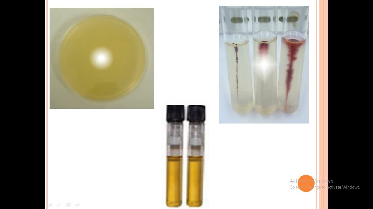 General Overview About Culture Media & Its Types