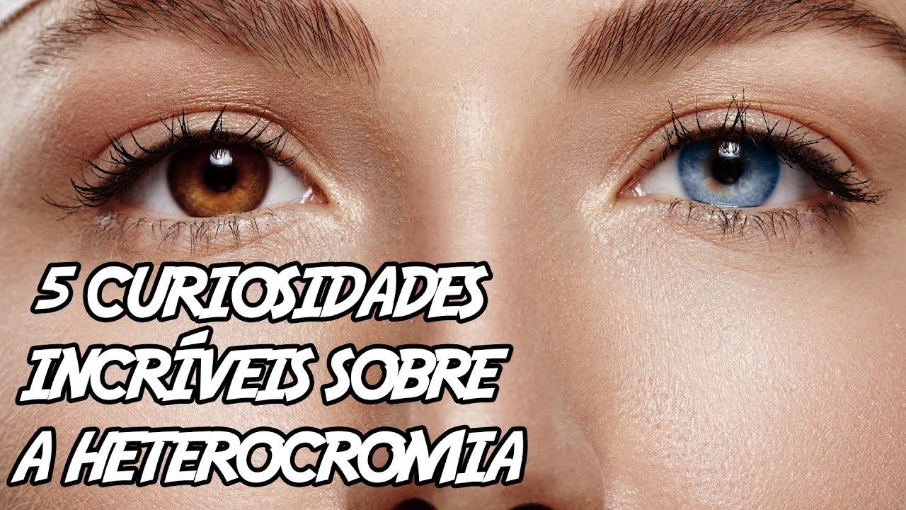 5 curiosidades sobre a Heterocromia