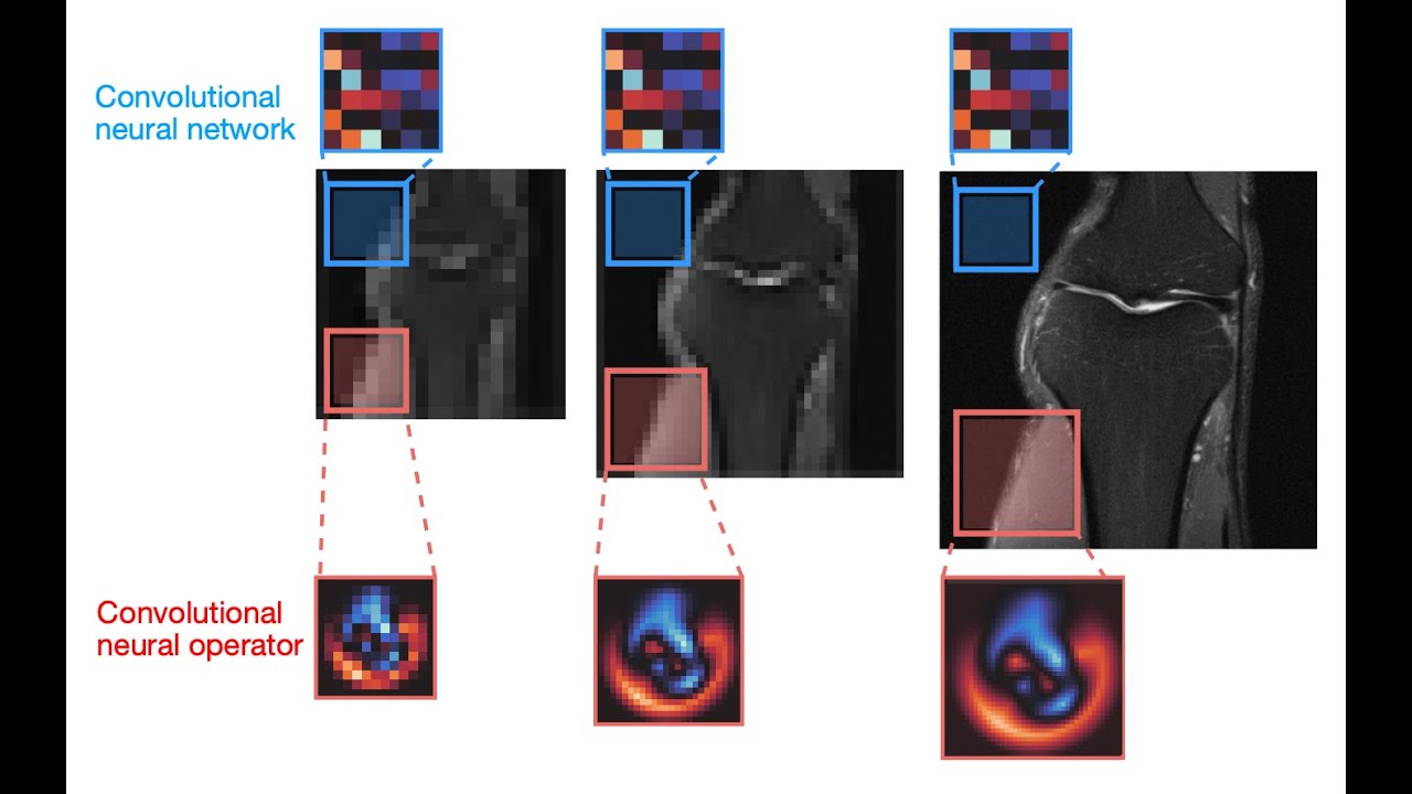A Unified Model for Compressed Sensing MRI Across Undersampling Patterns (CVPR 25)